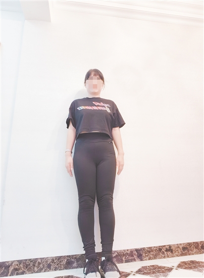 高女士減脂前后對比。