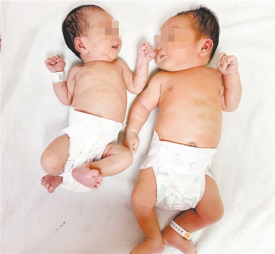 “重量級(jí)”寶寶比常見新生兒體型大了很多。