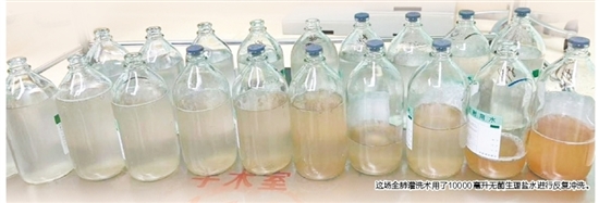 這場全肺灌洗術用了10000毫升無菌生理鹽水進行反復沖洗。